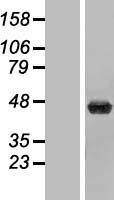 UPB1 Protein - Western validation with an anti-DDK antibody * L: Control HEK293 lysate R: Over-expression lysate