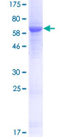 UPB1 Protein - 12.5% SDS-PAGE of human UPB1 stained with Coomassie Blue