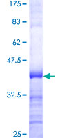 UPF3A / UPF3 Protein - 12.5% SDS-PAGE Stained with Coomassie Blue.