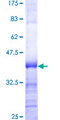 UPF3A / UPF3 Protein - 12.5% SDS-PAGE Stained with Coomassie Blue.