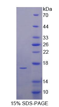 UPK1A / Uroplakin 1A Protein - Recombinant Uroplakin 1A By SDS-PAGE