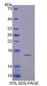 UPK2 / UPII / Uroplakin 2 Protein - Recombinant Uroplakin 2 By SDS-PAGE