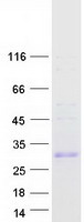 UPK2 / UPII / Uroplakin 2 Protein - Purified recombinant protein UPK2 was analyzed by SDS-PAGE gel and Coomassie Blue Staining