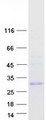 UPK2 / UPII / Uroplakin 2 Protein - Purified recombinant protein UPK2 was analyzed by SDS-PAGE gel and Coomassie Blue Staining