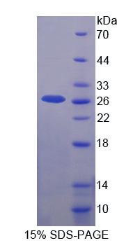 UPK3A / UPK3 / Uroplakin III Protein - Recombinant  Uroplakin 3A By SDS-PAGE