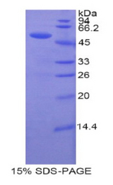 UPRT Protein - Recombinant Uracil Phosphoribosyltransferase By SDS-PAGE
