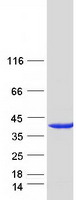 UPRT Protein - Purified recombinant protein UPRT was analyzed by SDS-PAGE gel and Coomassie Blue Staining