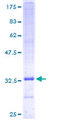 UQCR10 / UCRC Protein - 12.5% SDS-PAGE of human UCRC stained with Coomassie Blue