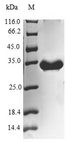 UQCR10 / UCRC Protein - (Tris-Glycine gel) Discontinuous SDS-PAGE (reduced) with 5% enrichment gel and 15% separation gel.