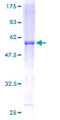 UQCRFS1 Protein - 12.5% SDS-PAGE of human UQCRFS1 stained with Coomassie Blue