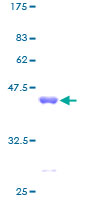 UQCRH Protein - 12.5% SDS-PAGE of human UQCRH stained with Coomassie Blue