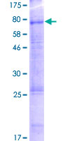 URAT1 / SLC22A12 Protein - 12.5% SDS-PAGE of human SLC22A12 stained with Coomassie Blue