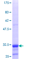 URAT1 / SLC22A12 Protein - 12.5% SDS-PAGE Stained with Coomassie Blue.