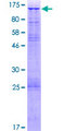 URG4 / URGCP Protein - 12.5% SDS-PAGE of human URG4 stained with Coomassie Blue