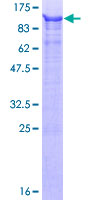 URI1 / NNX3 Protein - 12.5% SDS-PAGE of human C19orf2 stained with Coomassie Blue