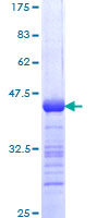URI1 / NNX3 Protein