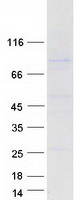 URI1 / NNX3 Protein - Purified recombinant protein URI1 was analyzed by SDS-PAGE gel and Coomassie Blue Staining