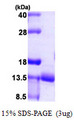 URM1 Protein