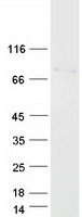 UROC1 Protein - Purified recombinant protein UROC1 was analyzed by SDS-PAGE gel and Coomassie Blue Staining