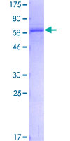 UROD Protein - 12.5% SDS-PAGE of human UROD stained with Coomassie Blue