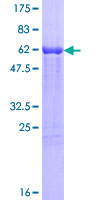 UROD Protein - 12.5% SDS-PAGE of human UROD stained with Coomassie Blue