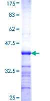 UROD Protein - 12.5% SDS-PAGE Stained with Coomassie Blue.