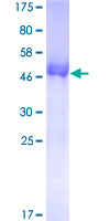 UROS Protein - 12.5% SDS-PAGE of human UROS stained with Coomassie Blue