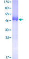 UROS Protein - 12.5% SDS-PAGE of human UROS stained with Coomassie Blue