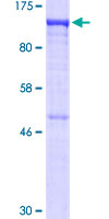 US01 / p115 Protein - 12.5% SDS-PAGE of human USO1 stained with Coomassie Blue