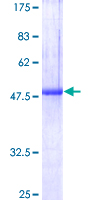 USAG1 / SOSTDC1 Protein - 12.5% SDS-PAGE of human SOSTDC1 stained with Coomassie Blue