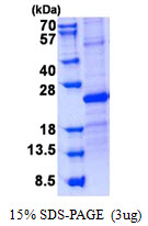 USAG1 / SOSTDC1 Protein