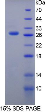 USAG1 / SOSTDC1 Protein - Recombinant Sclerostin Domain Containing Protein 1 By SDS-PAGE