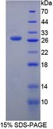 USAG1 / SOSTDC1 Protein - Recombinant Sclerostin Domain Containing Protein 1 By SDS-PAGE