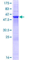 USE1 / p31 Protein - 12.5% SDS-PAGE of human USE1 stained with Coomassie Blue