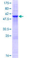 USE1 / p31 Protein - 12.5% SDS-PAGE of human USE1 stained with Coomassie Blue