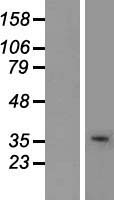 USF2 Protein - Western validation with an anti-DDK antibody * L: Control HEK293 lysate R: Over-expression lysate