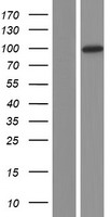 USP1 Protein - Western validation with an anti-DDK antibody * L: Control HEK293 lysate R: Over-expression lysate