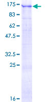 USP1 Protein - 12.5% SDS-PAGE of human USP1 stained with Coomassie Blue