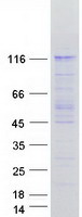 USP1 Protein - Purified recombinant protein USP1 was analyzed by SDS-PAGE gel and Coomassie Blue Staining