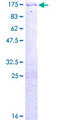 USP10 Protein - 12.5% SDS-PAGE of human USP10 stained with Coomassie Blue