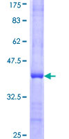 USP10 Protein - 12.5% SDS-PAGE Stained with Coomassie Blue.