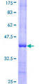 USP10 Protein - 12.5% SDS-PAGE Stained with Coomassie Blue.