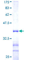 USP11 Protein - 12.5% SDS-PAGE Stained with Coomassie Blue.