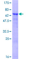 USP12 Protein - 12.5% SDS-PAGE of human USP12 stained with Coomassie Blue