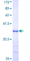 USP12 Protein - 12.5% SDS-PAGE Stained with Coomassie Blue.
