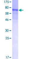 USP14 Protein - 12.5% SDS-PAGE of human USP14 stained with Coomassie Blue