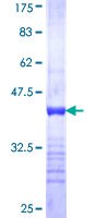 USP14 Protein - 12.5% SDS-PAGE Stained with Coomassie Blue.