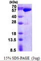 USP14 Protein