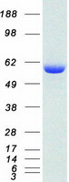 USP14 Protein - Purified recombinant protein USP14 was analyzed by SDS-PAGE gel and Coomassie Blue Staining