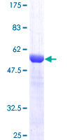 USP15 Protein - 12.5% SDS-PAGE of human USP15 stained with Coomassie Blue